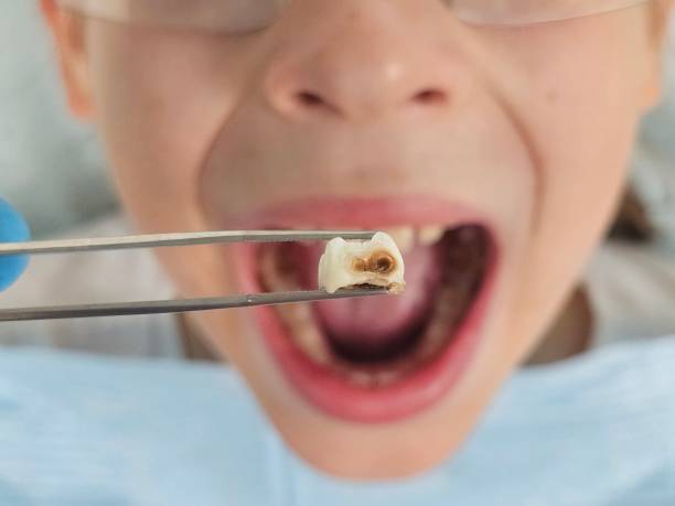 Best Pediatric Emergency Dentist in Heppner, OR